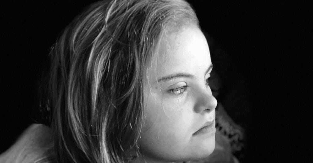 A grayscale portrait of a young caucasian girl with Down syndrome looking to the side thoughtfully.