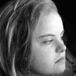 A grayscale portrait of a young caucasian girl with Down syndrome looking to the side thoughtfully.